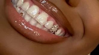 SWAROVKI-TOOTH-GEMS-IMAGE-2