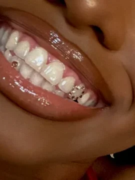 SWAROVKI-TOOTH-GEMS-IMAGE-2