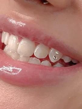 SWAROVKI-TOOTH-GEMS-IMAGE